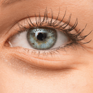 Contact Dr. Tattelbaum if you are interested in receiving under-eye fillers.