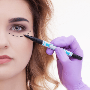 lower eyelid surgery