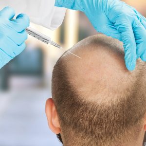 mens hair transplant