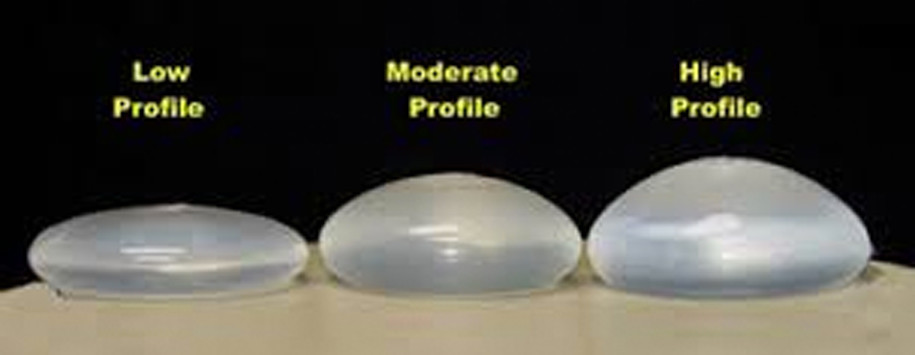 Low Moderate and High Profile Breast Surgery