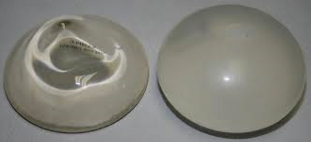 Silicone Implants