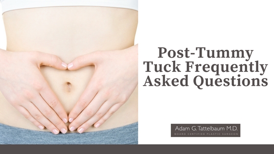 Post-Tummy Tuck Frequently Asked Questions