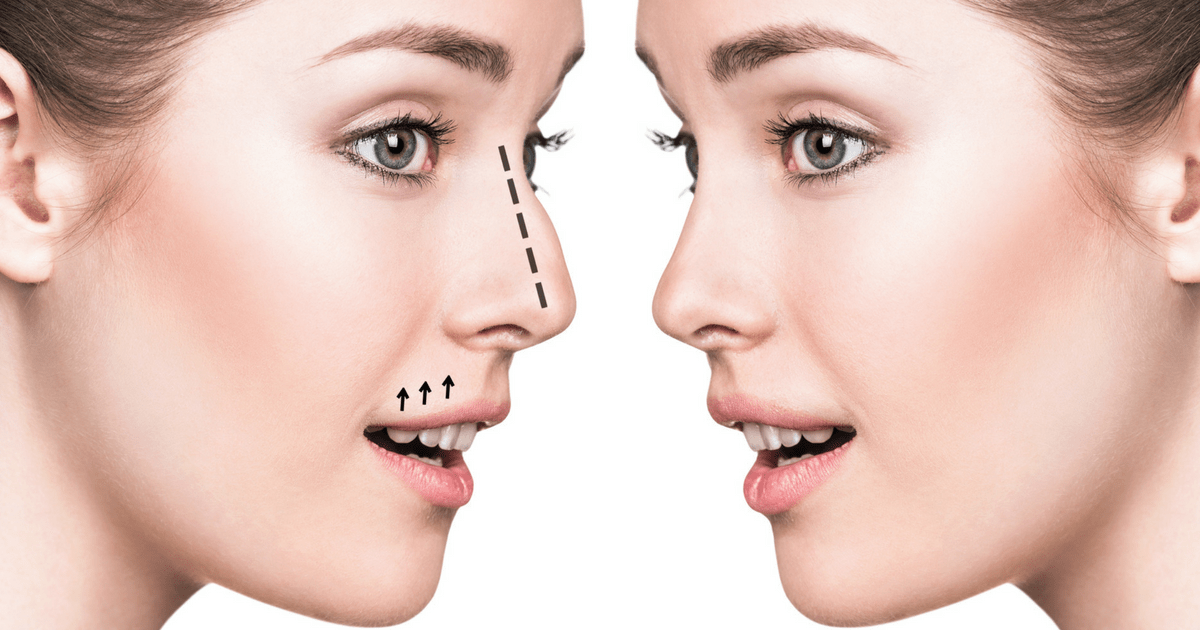 Nose Job Tips