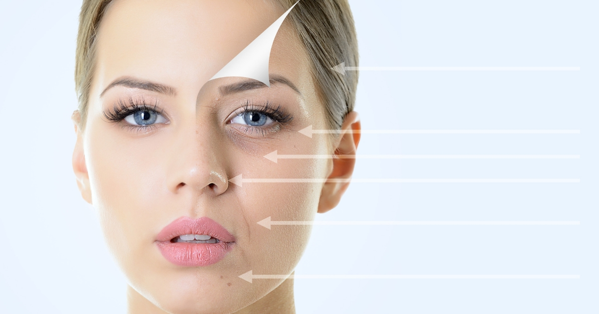 Facial rejuvenation