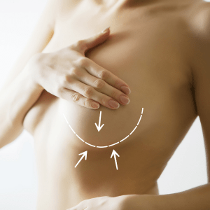 breast reduction surgery scars