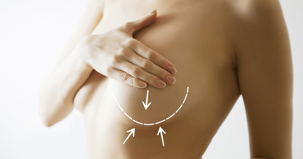 how to minimize scarring after breast reduction surgery